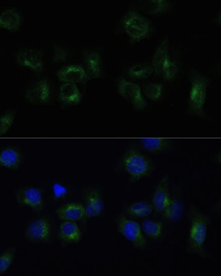 CLTB Antibody in Immunocytochemistry (ICC/IF)