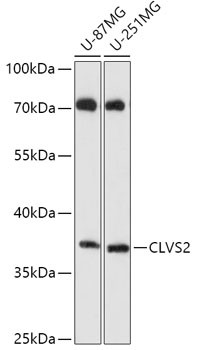 CLVS2 Antibody in Western Blot (WB)