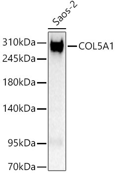 COL5A1 Antibody in Western Blot (WB)