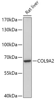 COL9A2 Antibody in Western Blot (WB)
