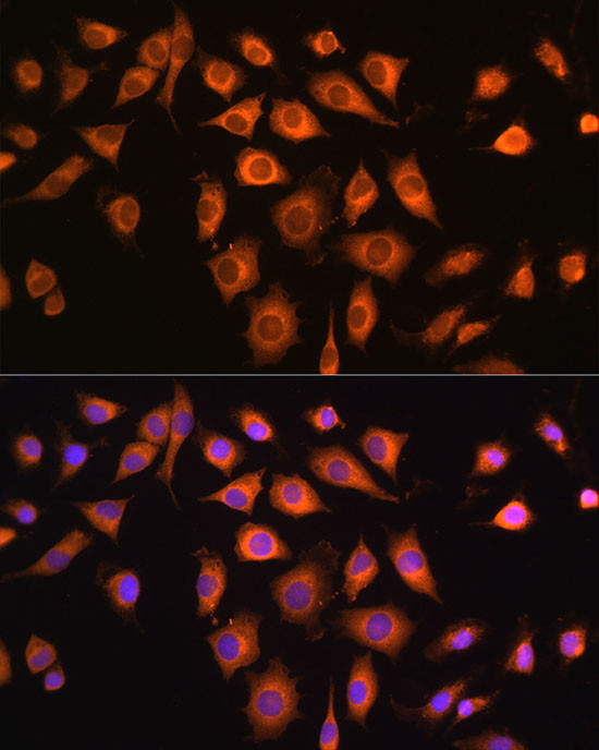 COPZ1 Antibody in Immunocytochemistry (ICC/IF)