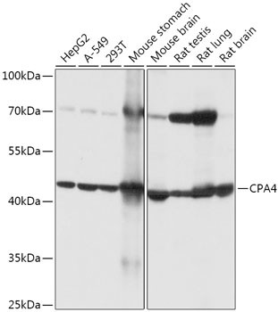 CPA4 Antibody in Western Blot (WB)