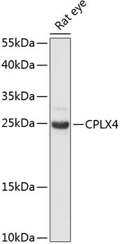 CPLX4 Antibody in Western Blot (WB)