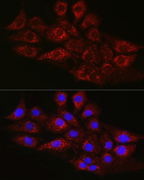 CPT2 Antibody in Immunocytochemistry (ICC/IF)