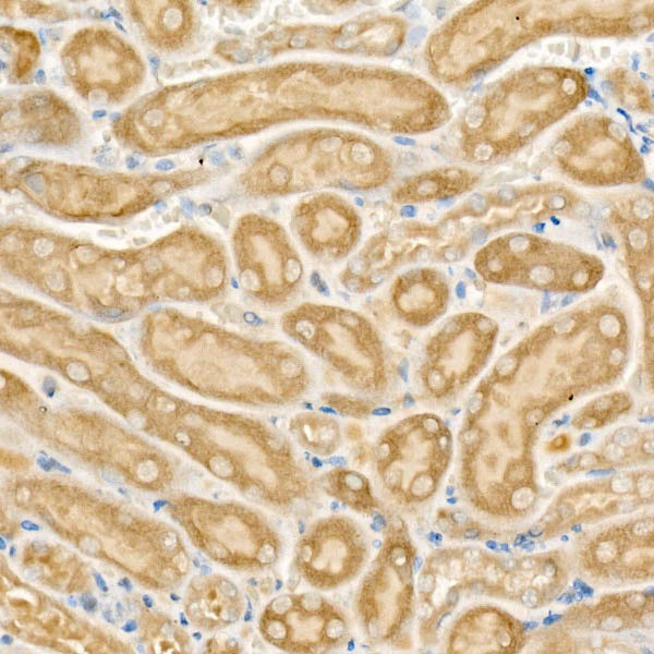 CPT2 Antibody in Immunohistochemistry (Paraffin) (IHC (P))