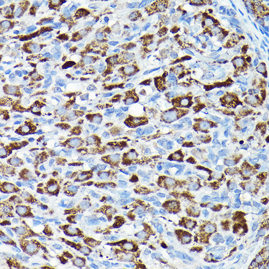 CYP11A1 Antibody in Immunohistochemistry (Paraffin) (IHC (P))