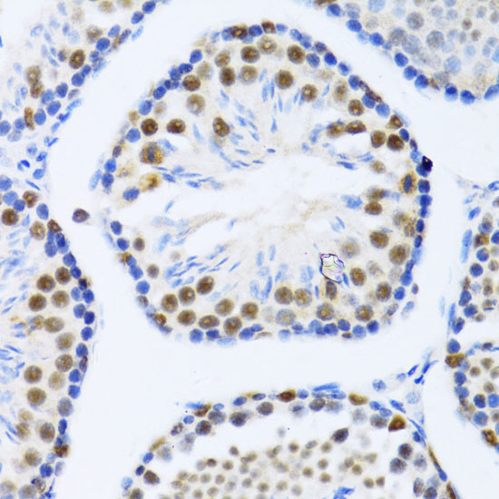 DDX46 Antibody in Immunohistochemistry (Paraffin) (IHC (P))