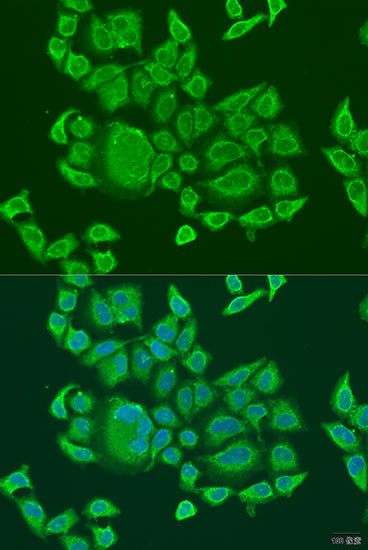 LGP2 Antibody in Immunocytochemistry (ICC/IF)