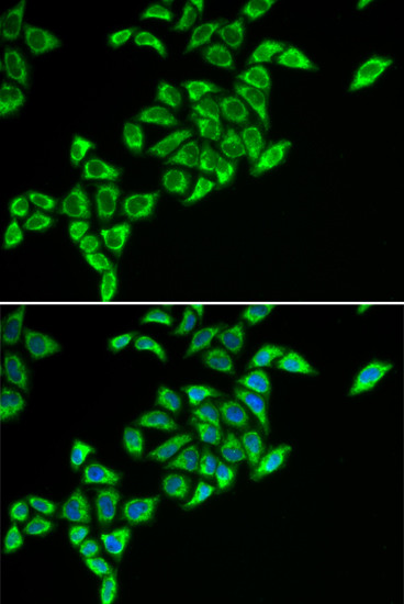 DLAT Antibody in Immunocytochemistry (ICC/IF)