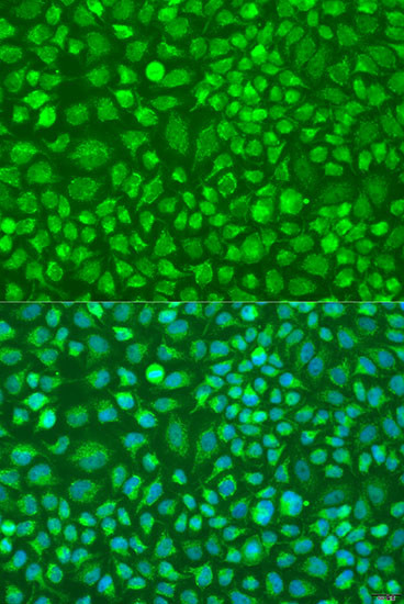 DNAL1 Antibody in Immunocytochemistry (ICC/IF)