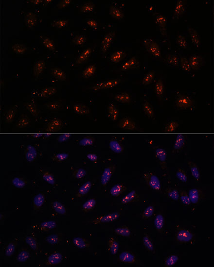 TDIF2 Antibody in Immunocytochemistry (ICC/IF)