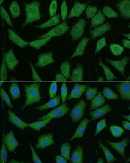 DRG2 Antibody in Immunocytochemistry (ICC/IF)