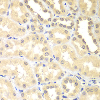 DTX2 Antibody in Immunohistochemistry (Paraffin) (IHC (P))