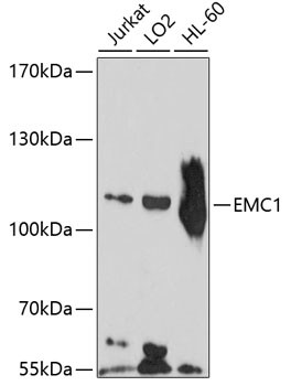 KIAA0090 Antibody in Western Blot (WB)