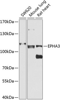 EphA3 Antibody in Western Blot (WB)