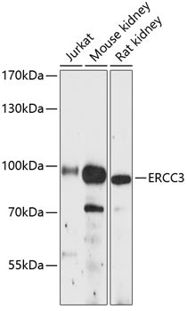 ERCC3 Antibody in Western Blot (WB)
