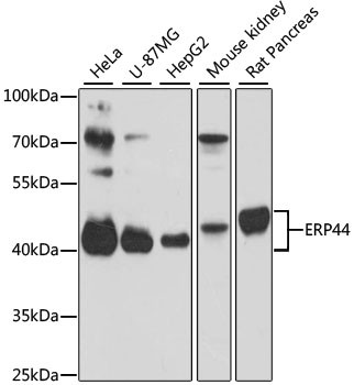 ERP44 Antibody in Western Blot (WB)