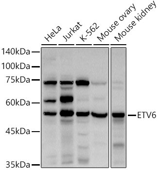 ETV6 Antibody in Western Blot (WB)