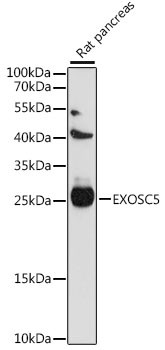 EXOSC5 Antibody in Western Blot (WB)
