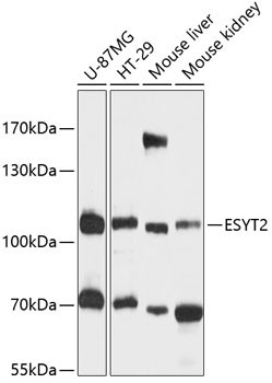 FAM62B Antibody in Western Blot (WB)