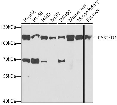 FASTKD1 Antibody in Western Blot (WB)