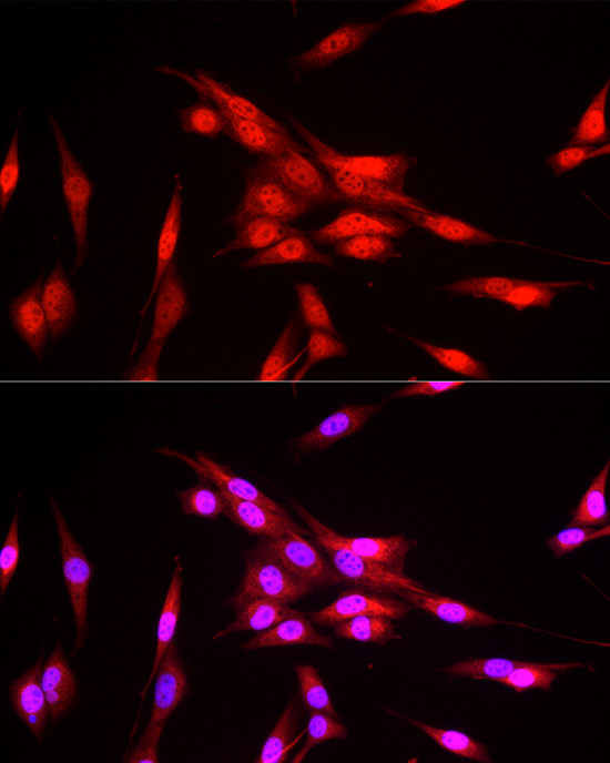 FBXW11 Antibody in Immunocytochemistry (ICC/IF)