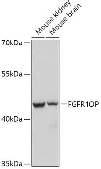 FGFR1OP Antibody in Western Blot (WB)