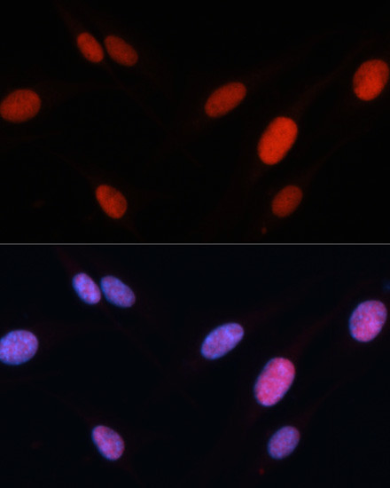 Fra2 Antibody in Immunocytochemistry (ICC/IF)