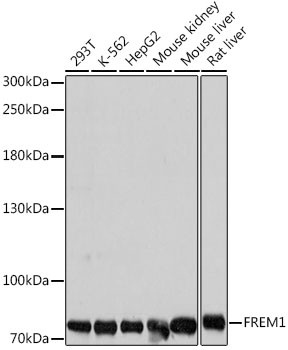 FREM1 Antibody in Western Blot (WB)