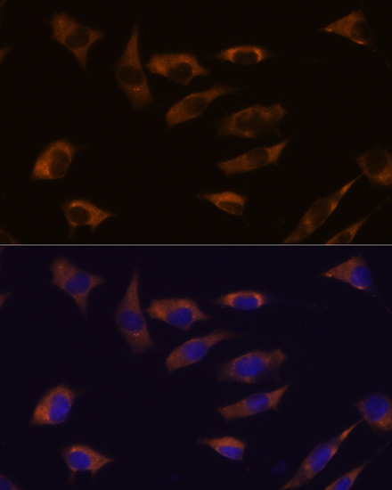 FSTL4 Antibody in Immunocytochemistry (ICC/IF)
