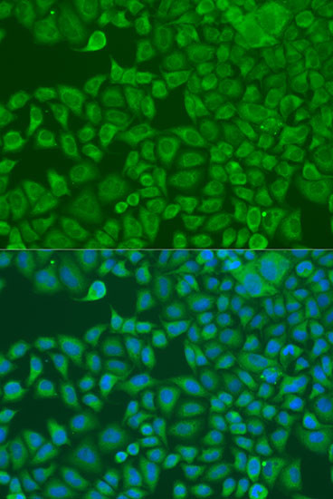 FXR2 Antibody in Immunocytochemistry (ICC/IF)