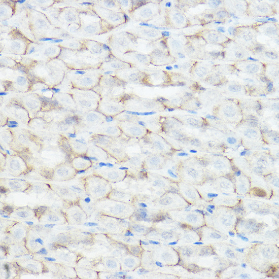 GABRA2 Antibody in Immunohistochemistry (Paraffin) (IHC (P))
