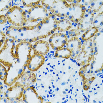 GDAP1 Antibody in Immunohistochemistry (Paraffin) (IHC (P))