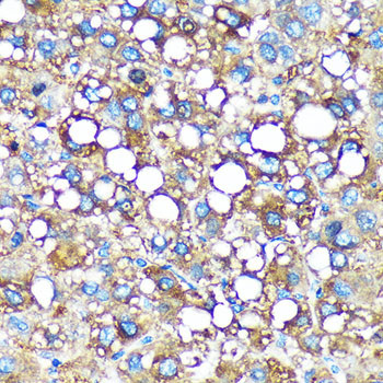 GMIP Antibody in Immunohistochemistry (Paraffin) (IHC (P))
