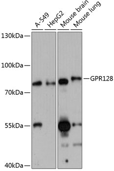 GPR128 Antibody in Western Blot (WB)