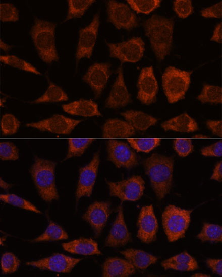 GRHPR Antibody in Immunocytochemistry (ICC/IF)