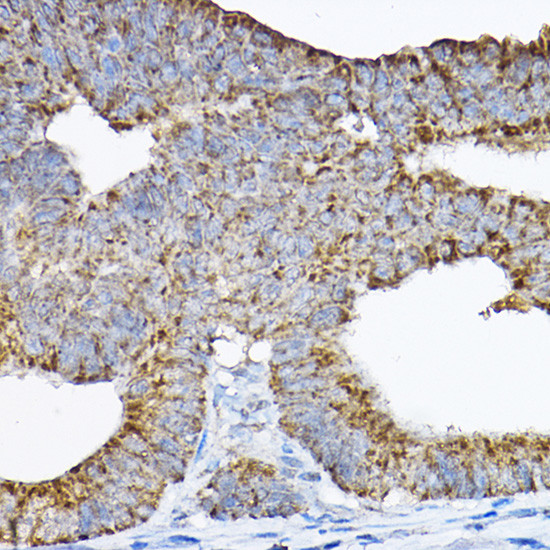 GRPEL2 Antibody in Immunohistochemistry (Paraffin) (IHC (P))