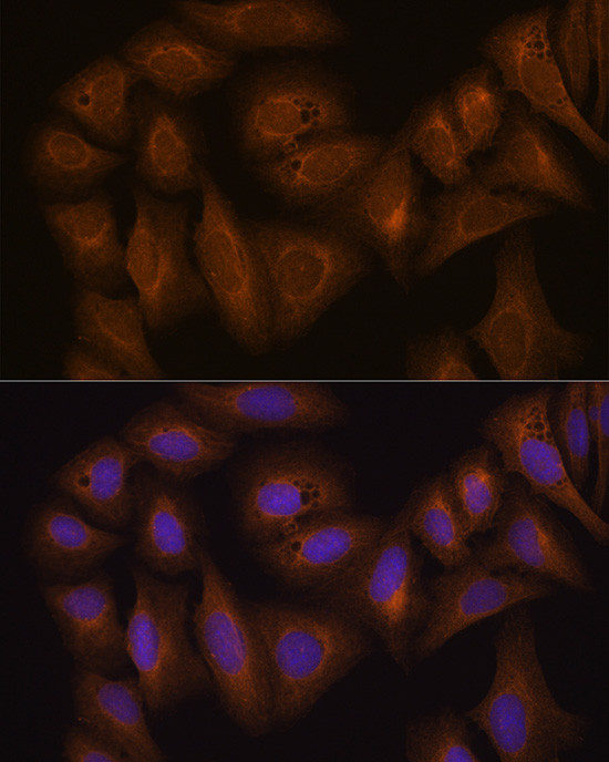 GSTA1 Antibody in Immunocytochemistry (ICC/IF)