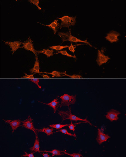 GSTM3 Antibody in Immunocytochemistry (ICC/IF)