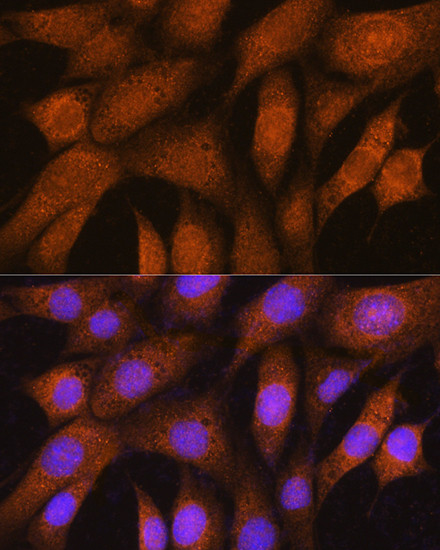 GSTT2B Antibody in Immunocytochemistry (ICC/IF)