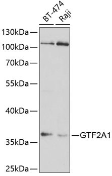 GTF2A1 Antibody in Western Blot (WB)