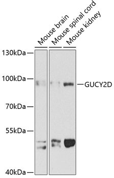 GUCY2D Antibody in Western Blot (WB)