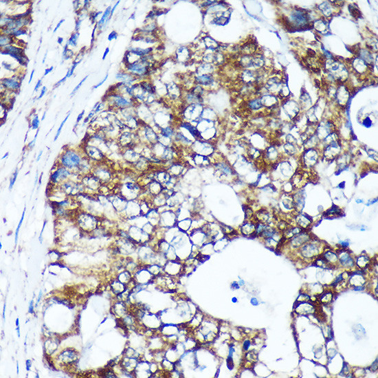 GULP1 Antibody in Immunohistochemistry (Paraffin) (IHC (P))
