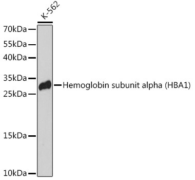HBA1 Antibody in Western Blot (WB)