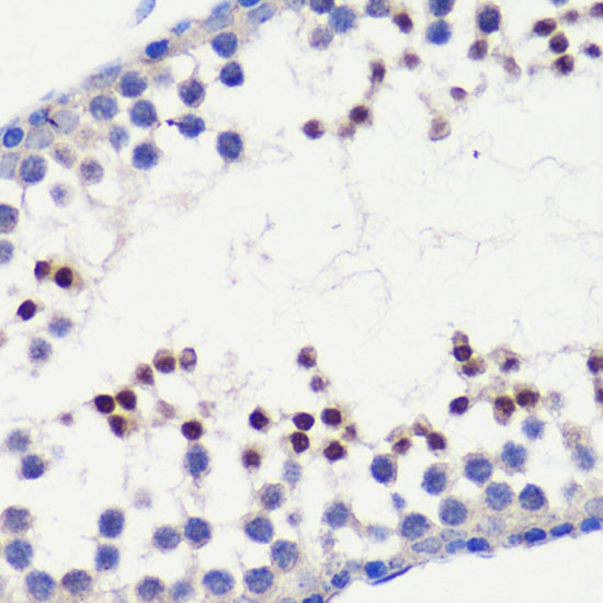 HFM1 Antibody in Immunohistochemistry (Paraffin) (IHC (P))