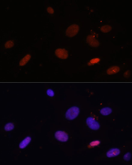 Histone H1.0 Antibody in Immunocytochemistry (ICC/IF)