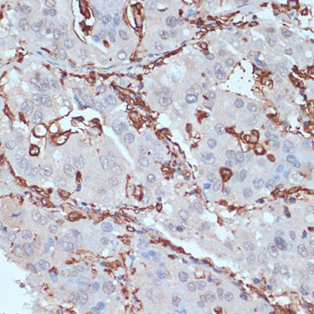 HLA-DRA Antibody in Immunohistochemistry (Paraffin) (IHC (P))