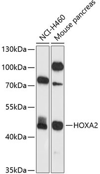 HOXA2 Antibody in Western Blot (WB)