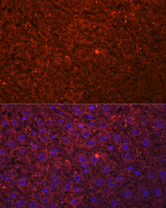 HSD17B13 Antibody in Immunocytochemistry (ICC/IF)