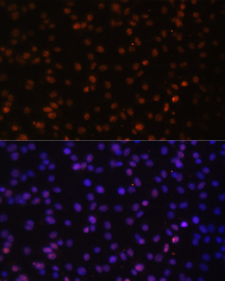 HTATSF1 Antibody in Immunocytochemistry (ICC/IF)